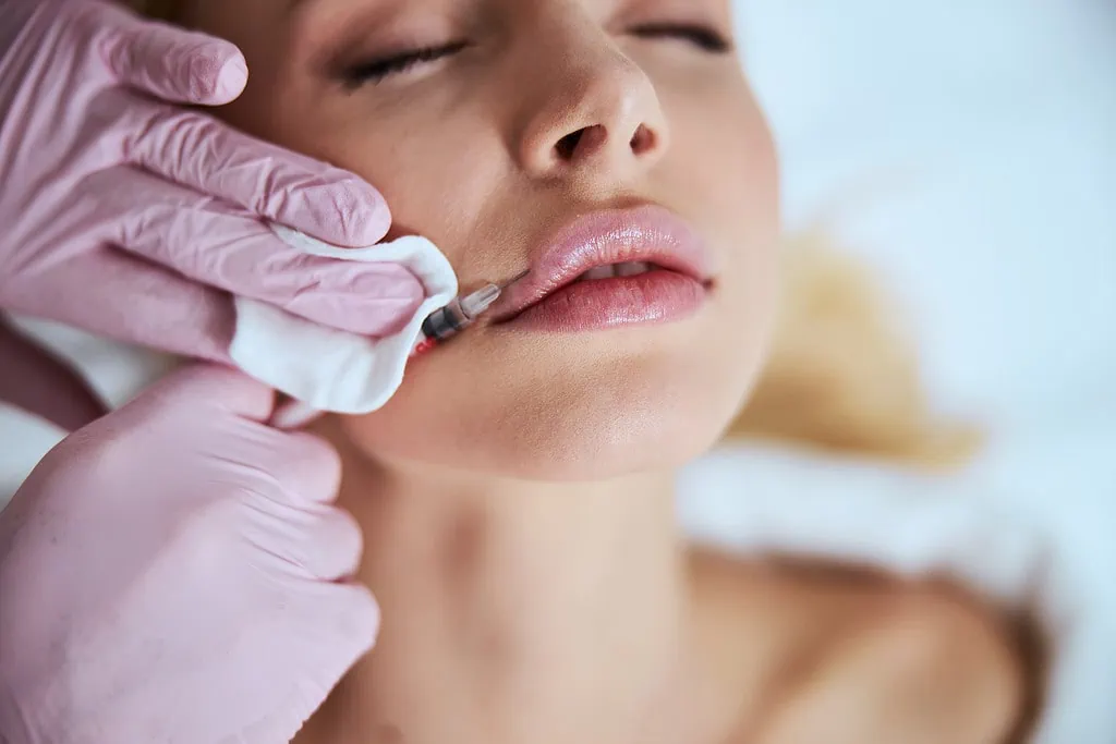 Gloved hand injecting patient's lips for cosmetic enhancement.