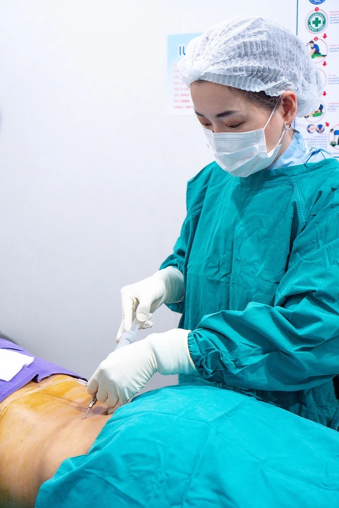 liposuction