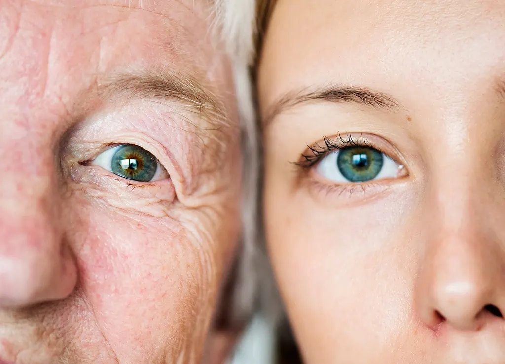 Side-by-side: aged skin with wrinkles next to smooth, youthful skin.
